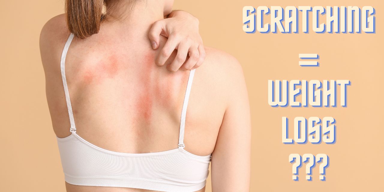 Do You Lose Weight When You Scratch Yourself – Silly Question or True?