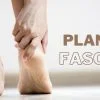 plantar-fasciitis